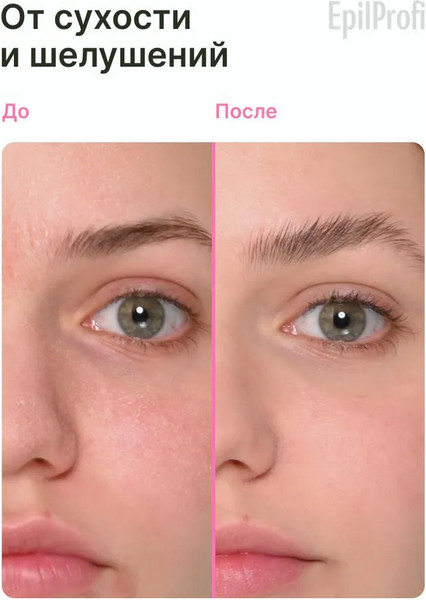 Изображение товара Крем для лица EpilProfi для глубокого увлажнения с мочевиной 10% (250мл, с дозатором)