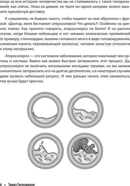 Изображение товара Книга АСТ Атеросклероз, мягкая обложка (Гаглошвили Тамаз)