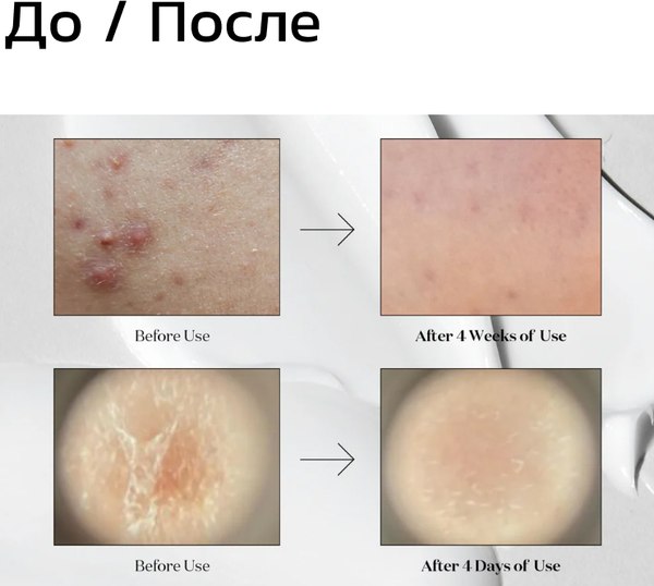 Изображение товара Сыворотка для лица Vt Cosmetics Midl Reedle Shot 50 с микроиглами для гладкой и сияющей кожи (50мл)