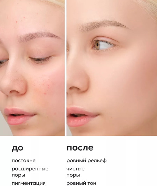 Изображение товара Пилинг для лица Likato Professional C АНА кислотами (30мл)