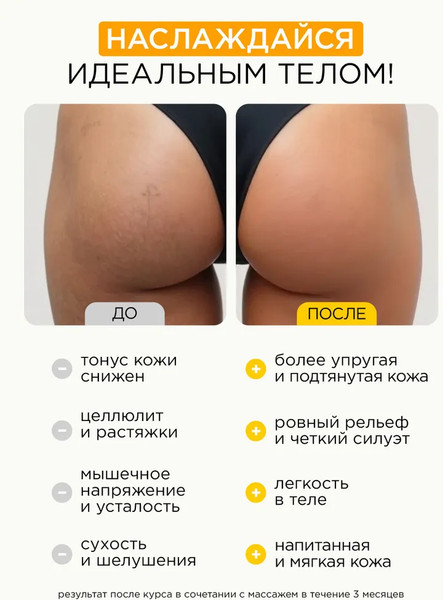 Изображение товара Масло для тела MIXIT Body Sculpt против несовершенств (400мл)