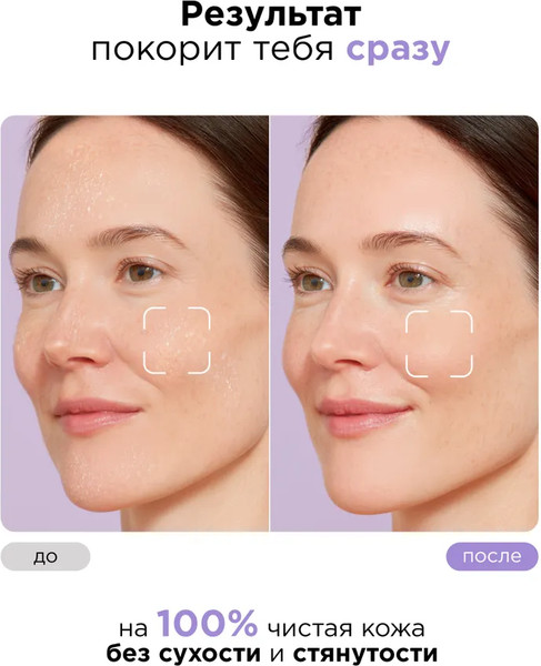 Изображение товара Пенка для умывания MIXIT Увлажняющая с гиалуроновой кислотой (150мл)