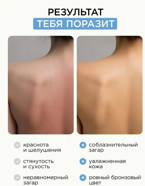 Изображение товара Крем после загара MIXIT Для лица и тела (150мл)