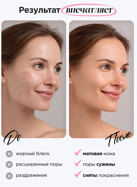 Изображение товара Тоник для лица MIXIT Матирующий с ниацинамидом (500мл)