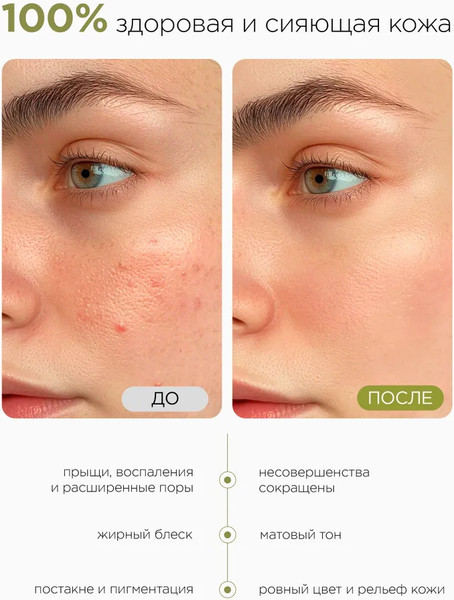 Изображение товара Гель для умывания MIXIT Stop Acne Очищающий с кислотами для проблемной кожи (250мл)