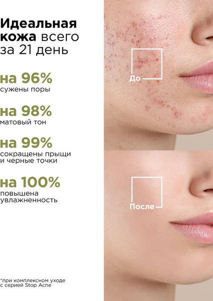 Изображение товара Крем для лица MIXIT Stop Acne с кислотами для проблемной кожи (50мл)