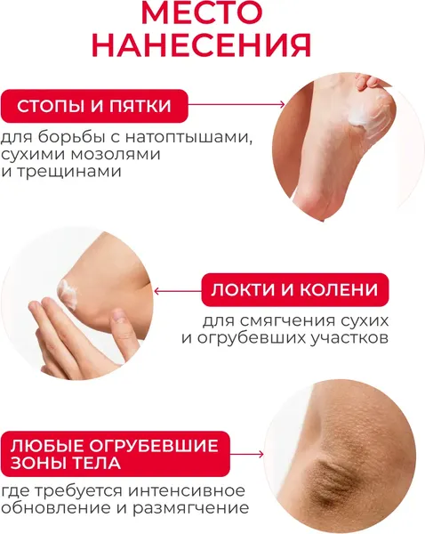 Изображение товара Крем для ног Dermanorma от трещин и натоптышей с мочевиной 40% (100мл)