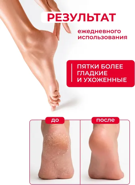 Изображение товара Крем для ног Dermanorma от трещин и натоптышей с мочевиной 40% (100мл)