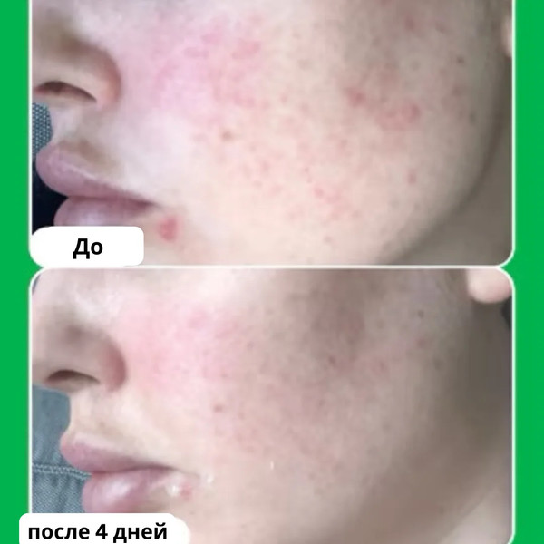 Изображение товара Сыворотка для лица Paula's Choice 10% Azelaic Acid Booster (30мл)