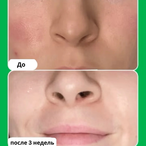 Изображение товара Сыворотка для лица Paula's Choice 10% Azelaic Acid Booster (30мл)