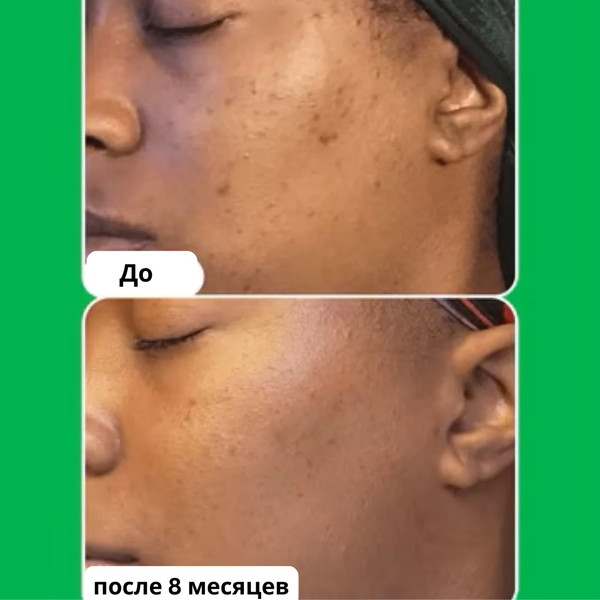 Изображение товара Сыворотка для лица Paula's Choice 10% Azelaic Acid Booster (30мл)