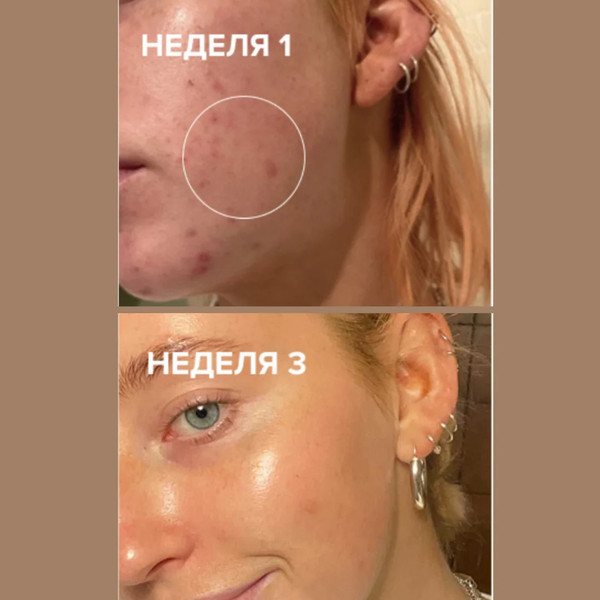 Изображение товара Тоник для лица Paula's Choice Skin perfecting 2% BHA Liquid (118мл)