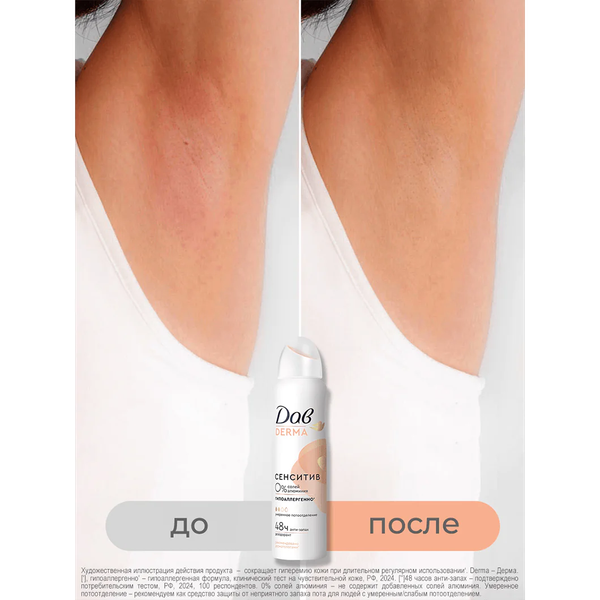 Изображение товара Дезодорант-спрей Dove Derma Сенситив гипоаллергенный (150мл)