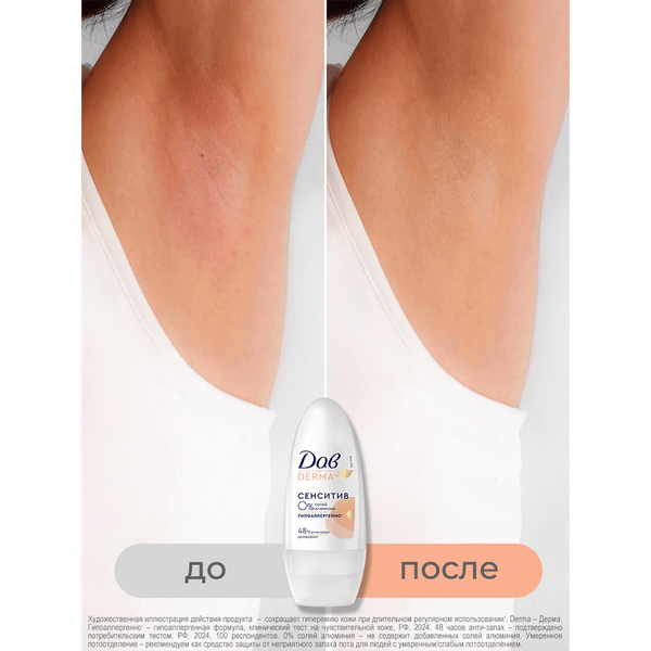 Изображение товара Дезодорант шариковый Dove Derma Сенситив гипоаллергенный (50мл)