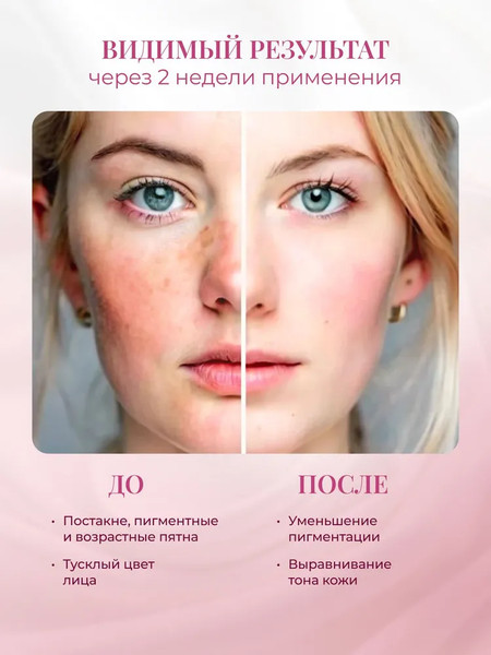 Изображение товара Крем для лица Rose of Bulgaria Отбеливающий с UV-фильтром (50мл)