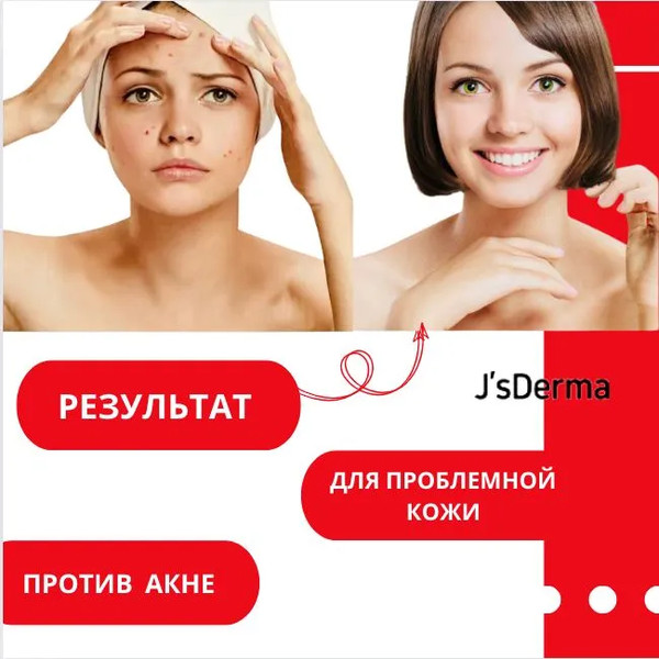 Изображение товара Сыворотка для лица JsDerma Acnetrix Control AC Serum (30мл)