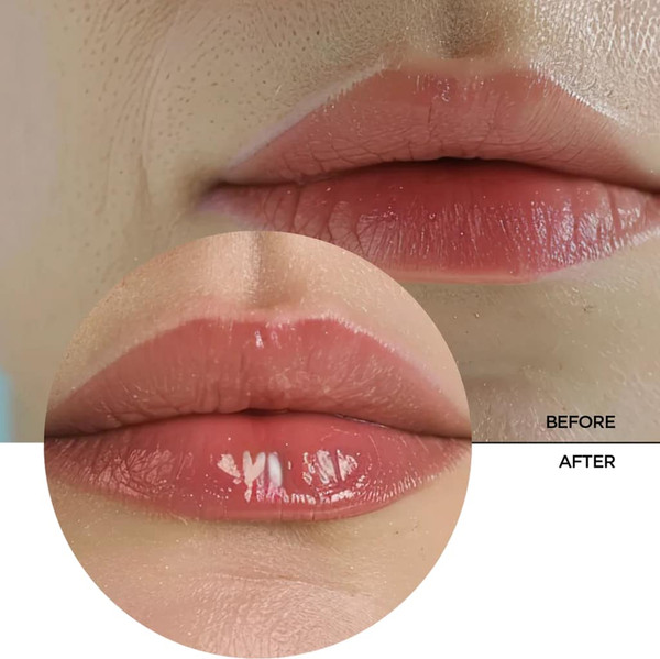 Изображение товара Бальзам для губ Revox B77 Lip Filler Hyaluronic Acid (12мл)