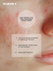 Миниатюра изображения товара Тоник для лица Clean+ Acne Control (200мл)