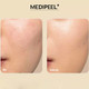 Миниатюра изображения товара Эссенция для лица Medi-Peel Peptide 9 Golden Camellia Wrinkle Essence (50мл)