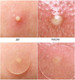 Миниатюра изображения товара Маска для лица гидрогелевая Elizavecca Witch Piggy Hell-Pore Blemish Spot Patch для проблемной кожи (44шт)