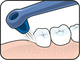 Миниатюра изображения товара Зубная щетка монопучковая TePe Interspace+ Medium (12 насадок)