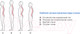 Миниатюра изображения товара Корректор осанки Польза 0502 (р.4, черный)