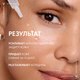 Миниатюра изображения товара Сыворотка для лица Vichy Liftactiv Supreme с витамином С (20мл)