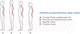 Миниатюра изображения товара Корректор осанки Польза 0502 (р.4, бежевый)