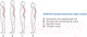 Миниатюра изображения товара Корректор осанки Польза 0506 (р.1, бежевый)