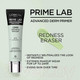 Миниатюра изображения товара Основа под макияж L'Oreal Paris Prime Lab Redness Eraser (30мл)