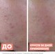 Миниатюра изображения товара Сыворотка для лица Avene Cleanance AHA Exfoliating Serum Для жирной кожи (30мл)