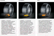 Миниатюра изображения товара Летняя шина Continental SportContact 6 295/35R20 105Y Mercedes
