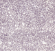 Миниатюра изображения товара Жидкие обои Silk Plaster Мастер-Шелк MS-25+2