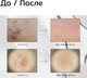 Миниатюра изображения товара Сыворотка для лица Vt Cosmetics Midl Reedle Shot 50 с микроиглами для гладкой и сияющей кожи (50мл)