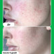 Миниатюра изображения товара Сыворотка для лица Paula's Choice 10% Azelaic Acid Booster (30мл)